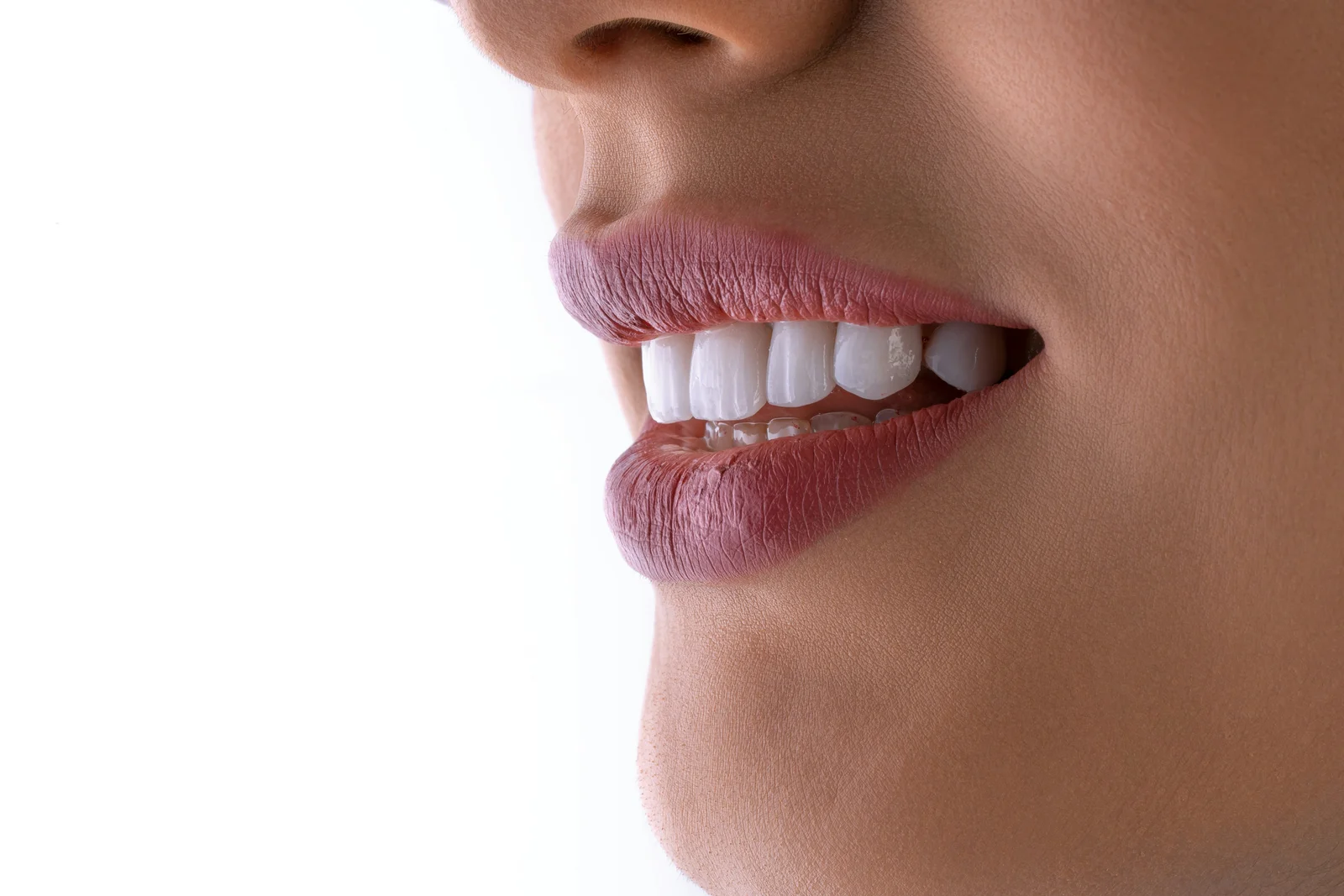 Estetică dentară la SamiDent PLUS în București Sector 2